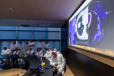 Radiochirurgia Zagreb koristi umjetnu inteligenciju kod liječenja tumora